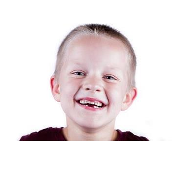 Gotta Smile Plan - second stripe account